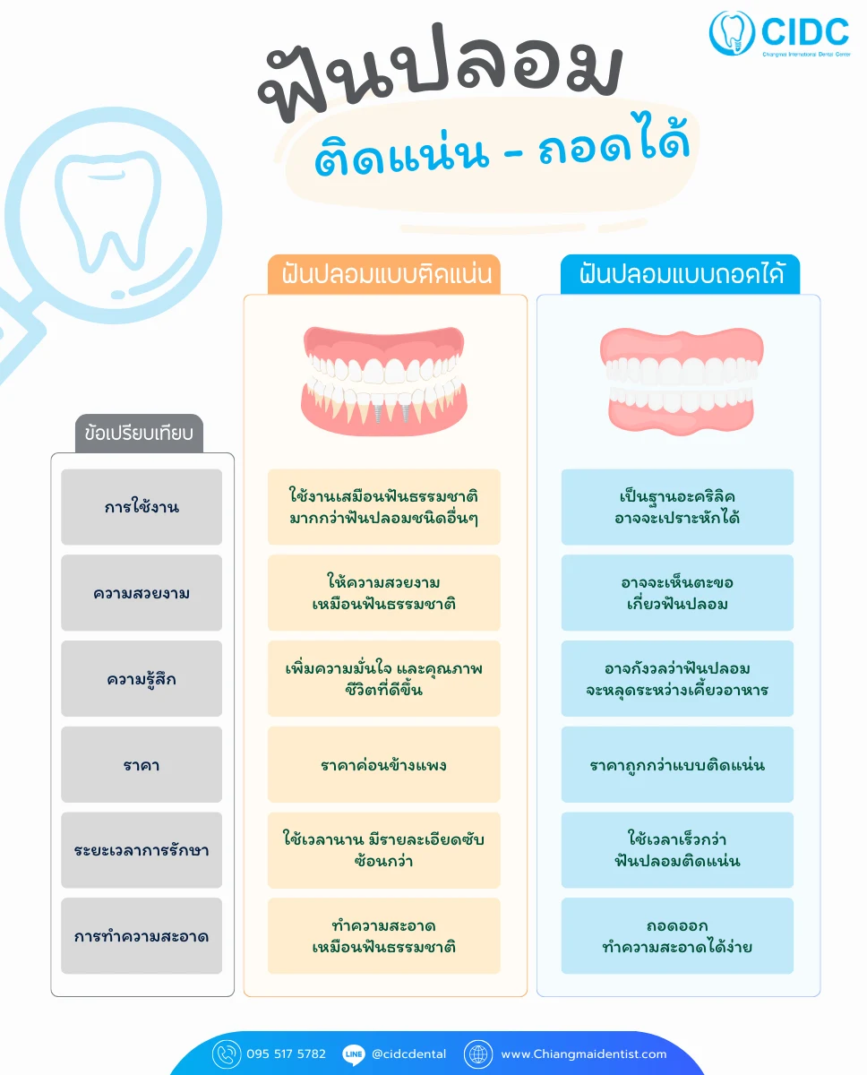 ทำฟันปลอมเลือกแบบไหนดี
