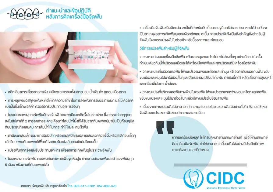 วิธีดูแลตัวเอง หลังจัดฟัน