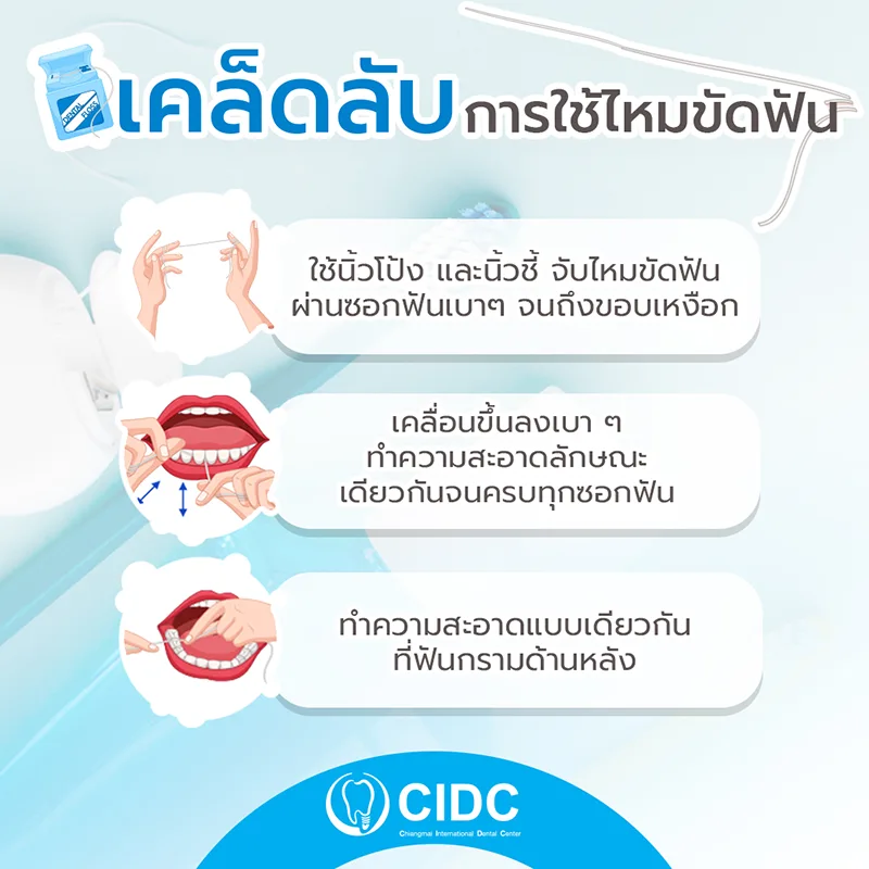 ขั้นตอนการใช้ไหมขัดฟัน