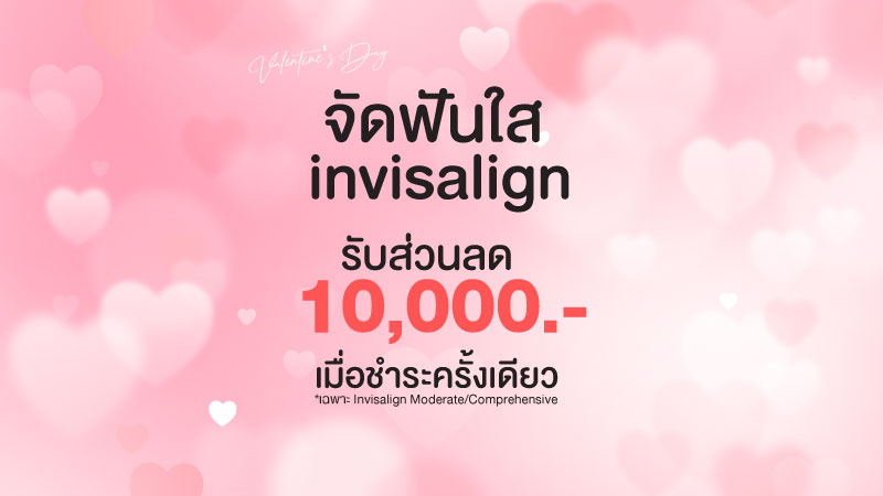 โปรจัดฟันใส เชียงใหม่