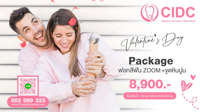 ราคา ฟอกสีฟัน เชียงใหม่