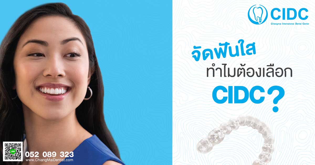 จัดฟันใส เชียงใหม่