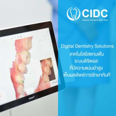 สแกนฟัน 3D