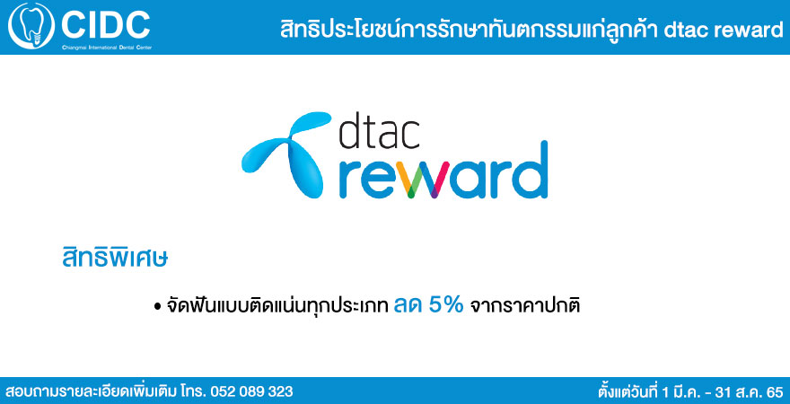 จัดฟันเชียงใหม่ dtac Reward