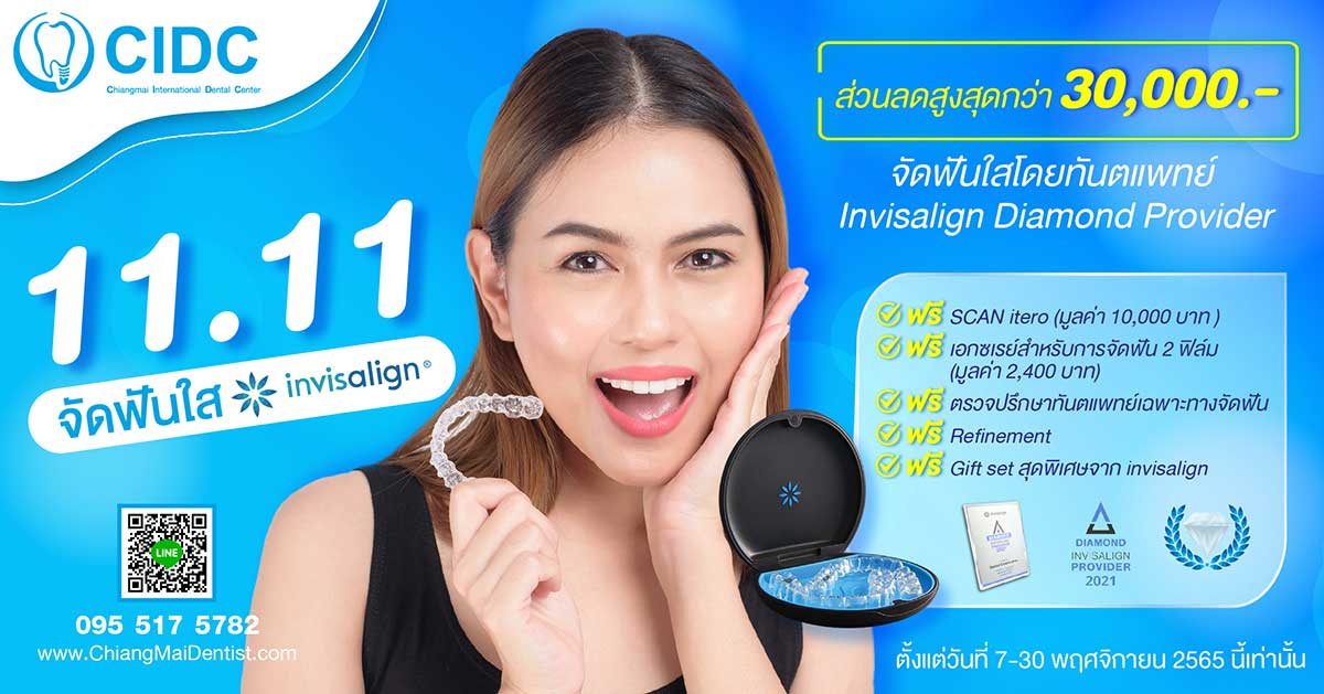 โปรโมชั่น invisalign