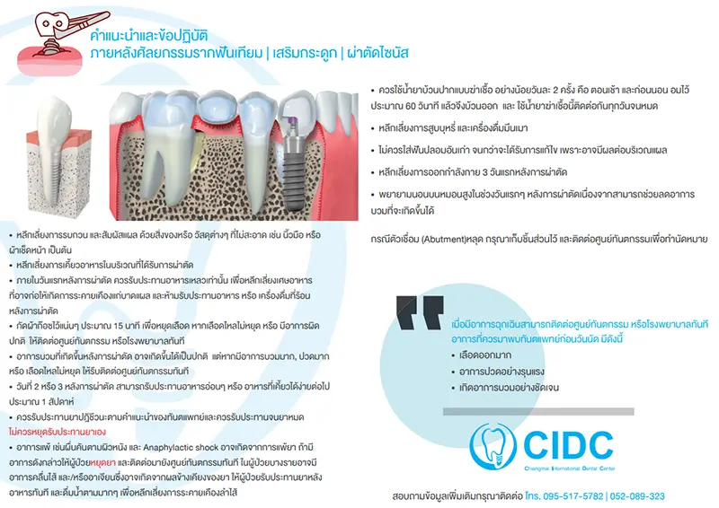 หลังทำรากเทียม ดูแลตัวเองยังไง