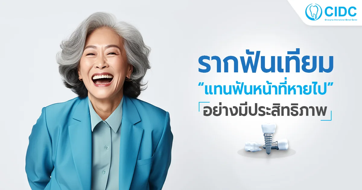 รากฟันเทียม