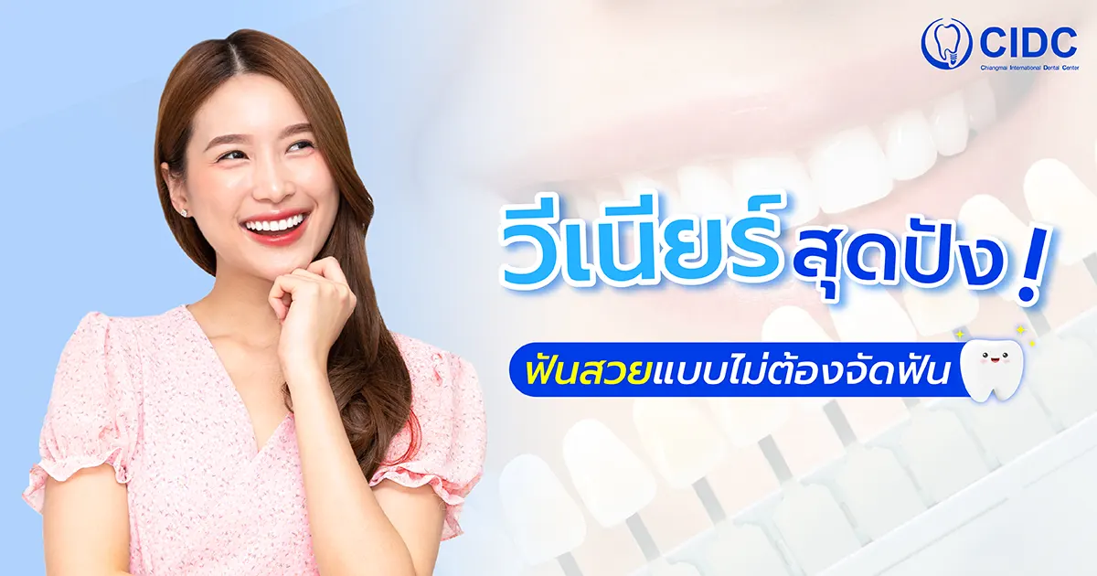 วีเนียร์