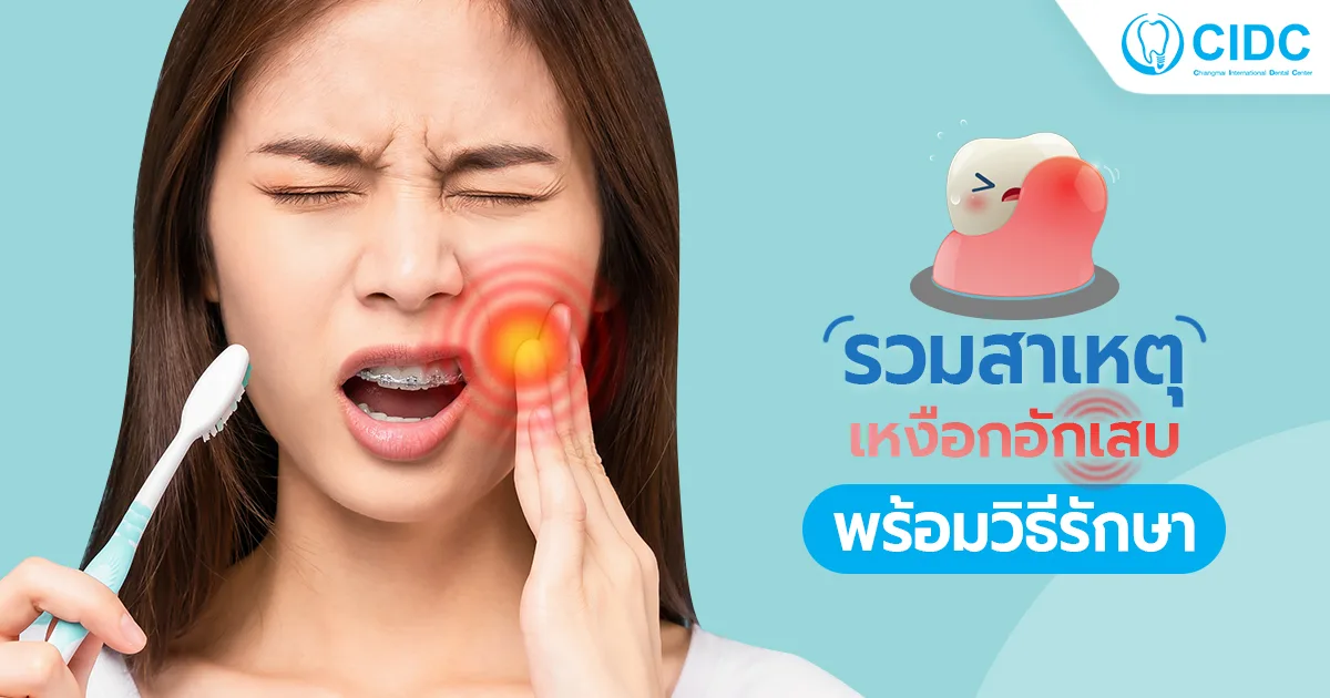 เหงือกอักเสบ