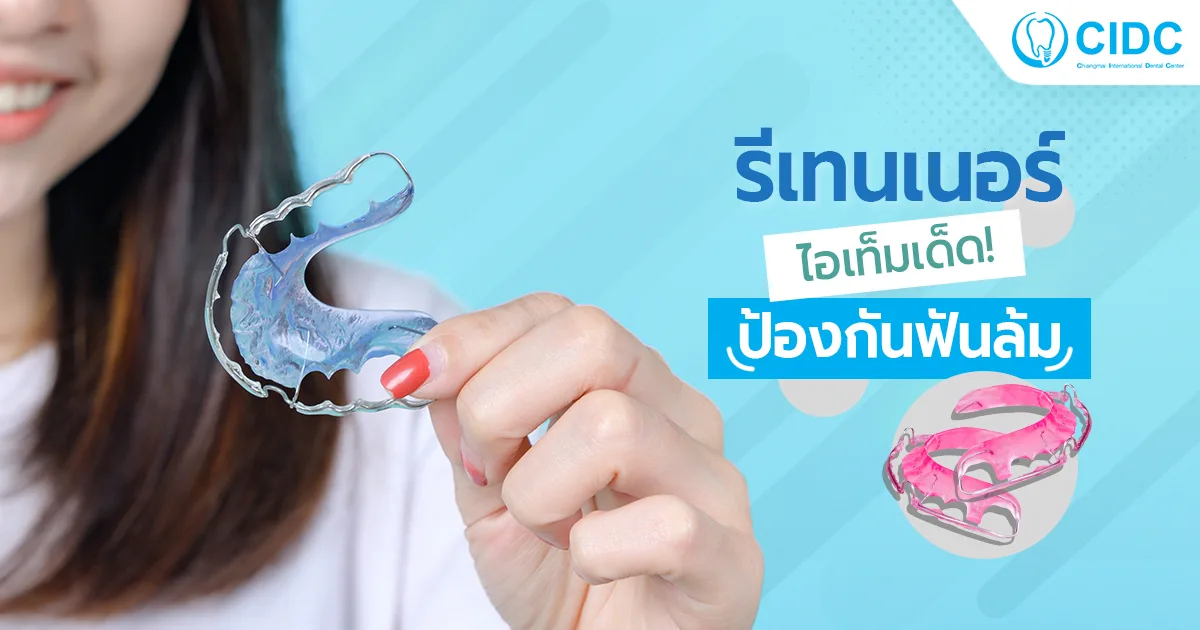 รีเทนเนอร์