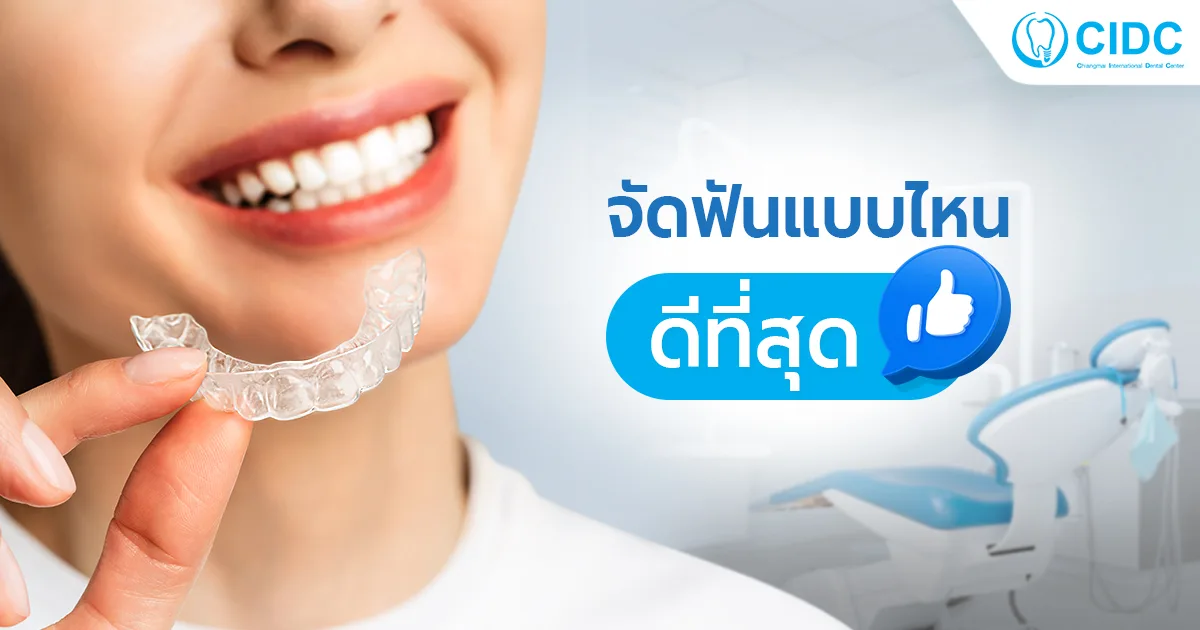 จัดฟัน แบบไหนดี