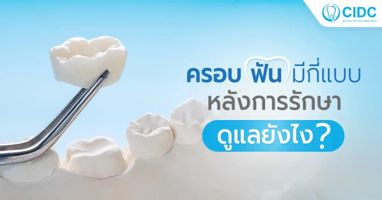 ครอบฟันมีกี่แบบ