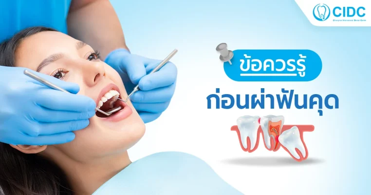 ผ่าฟันคุด