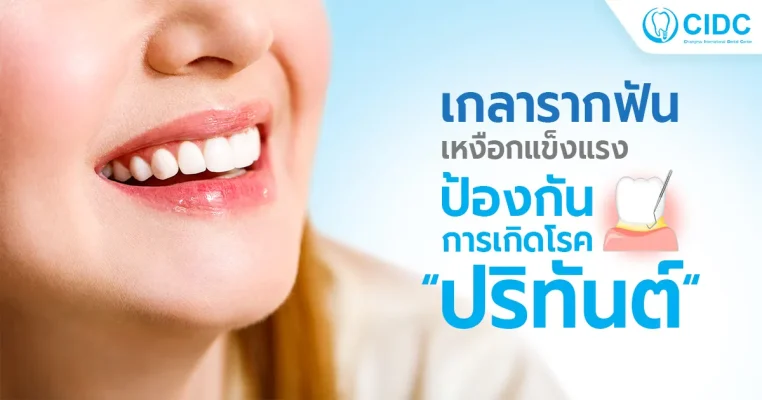 เกลารากฟัน