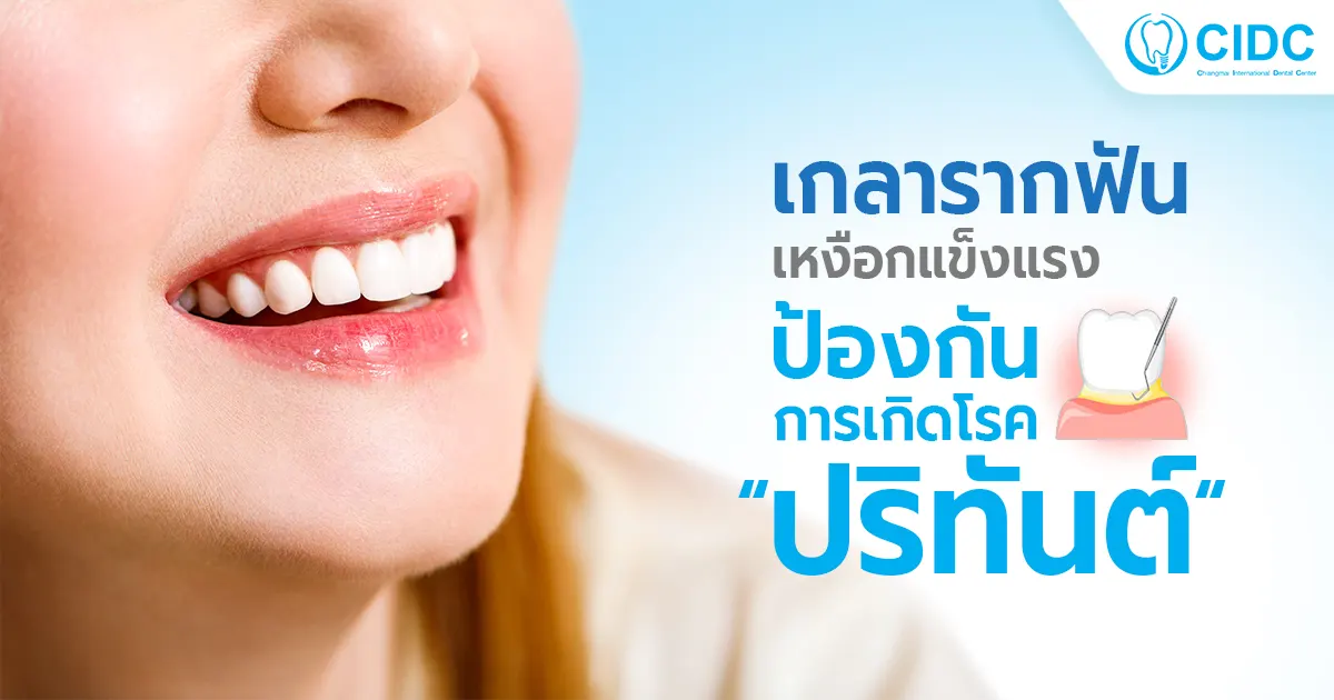 เกลารากฟัน