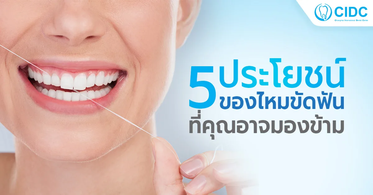 ไหมขัดฟัน