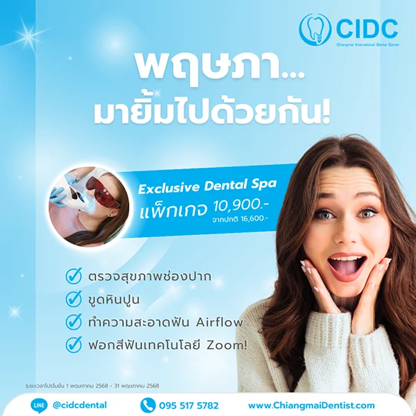 โปรโมชั่นสปาฟันขาว เชียงใหม่