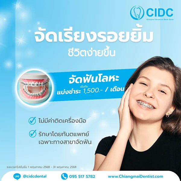จัดฟันราคานักเรียน