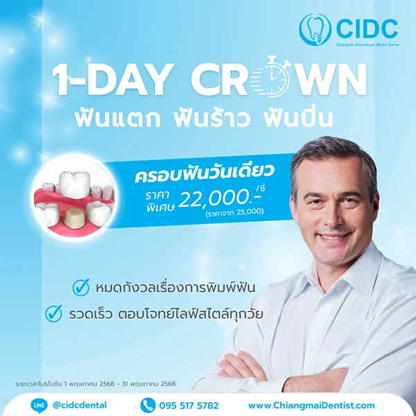 ครอบฟัน ราคา เชียงใหม่