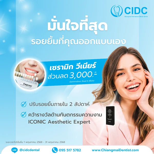 ราคา วีเนียร์เชียงใหม่