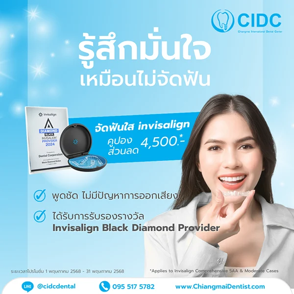 จัดฟันใส เชียงใหม่