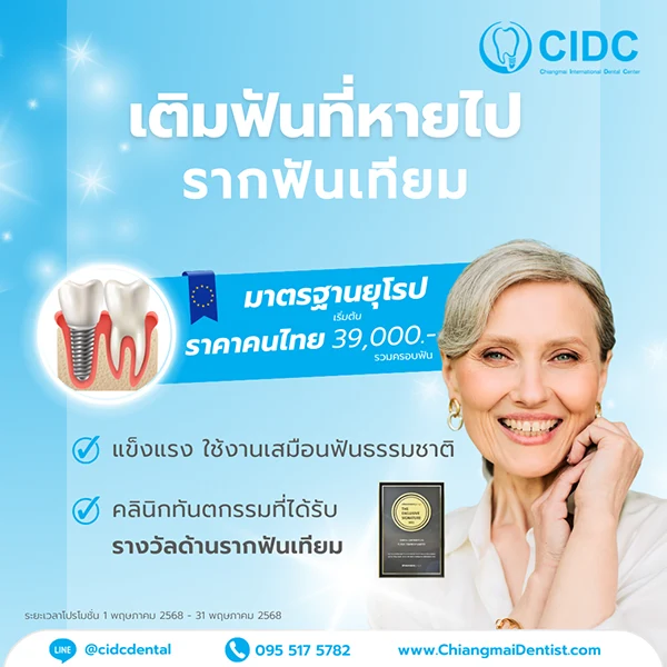 ราคารากฟันเทียม 2568