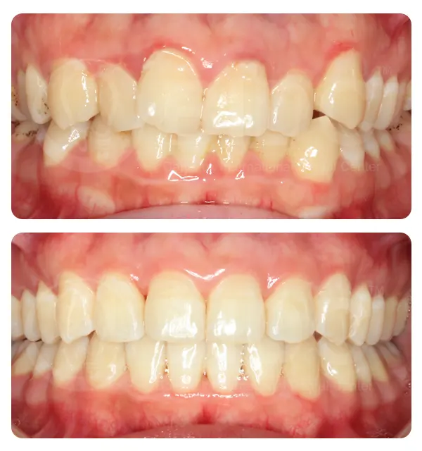 Phuket Dental Phuket Dental