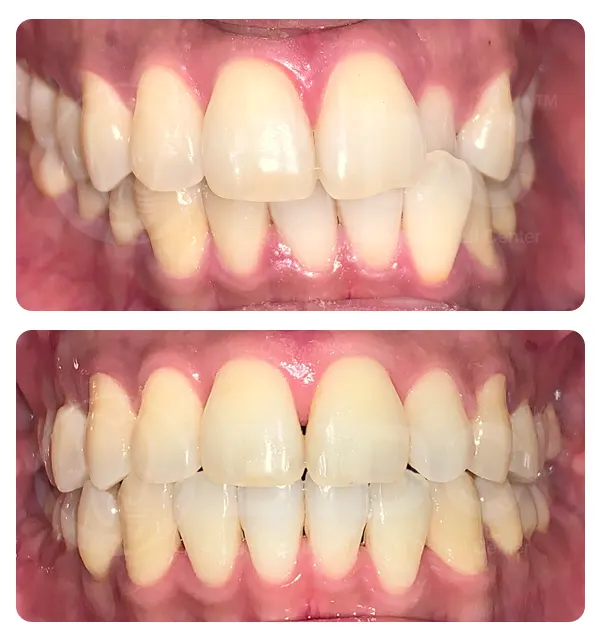 Phuket Dental Phuket Dental
