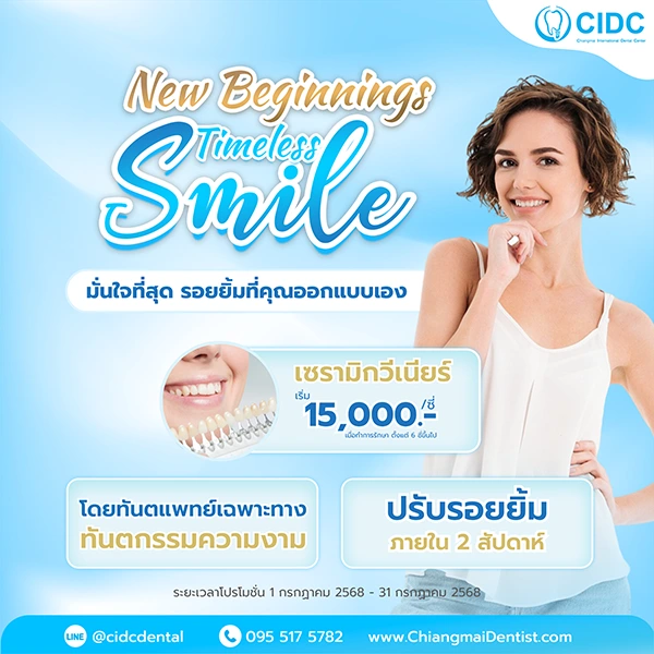 ราคา วีเนียร์เชียงใหม่