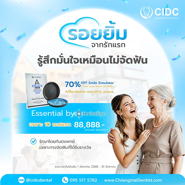 จัดฟันใส เชียงใหม่