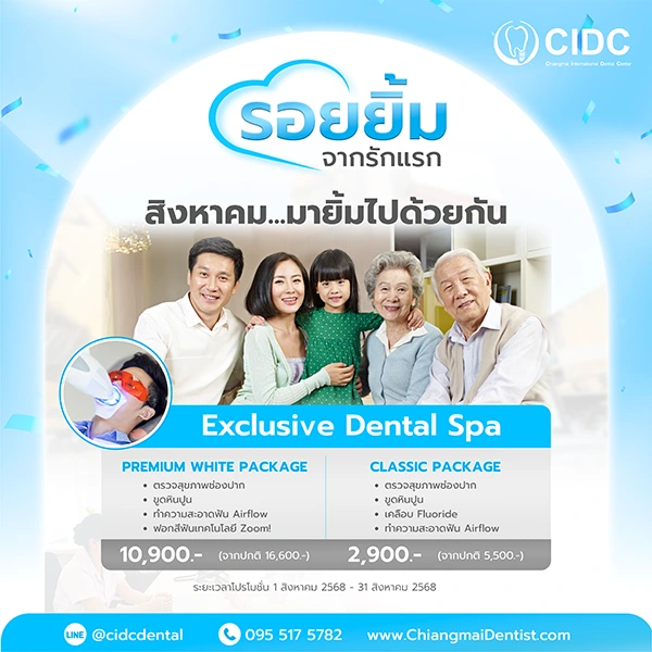 โปรโมชั่นสปาฟันขาว เชียงใหม่