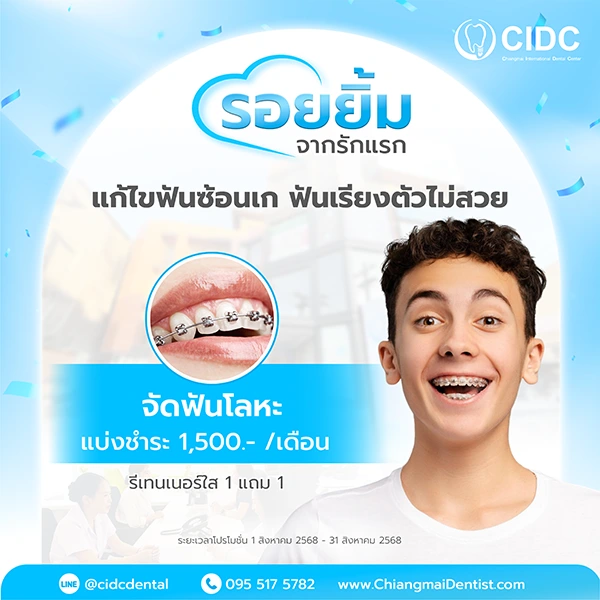 จัดฟันราคา