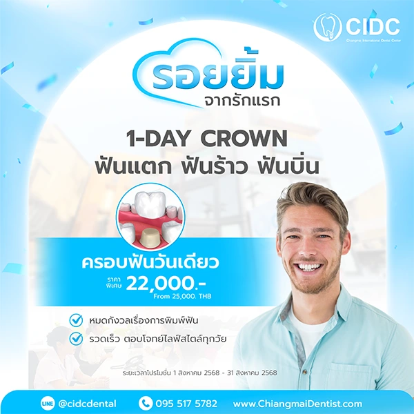 ครอบฟัน ราคา เชียงใหม่