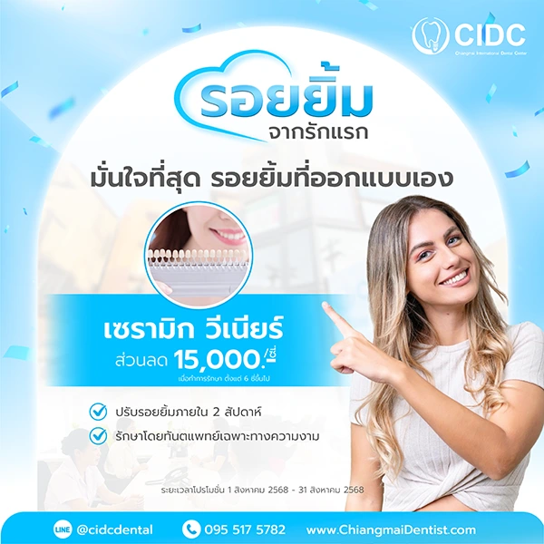 ราคา วีเนียร์เชียงใหม่