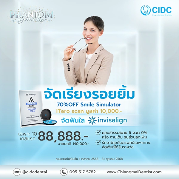 จัดฟันใส เชียงใหม่