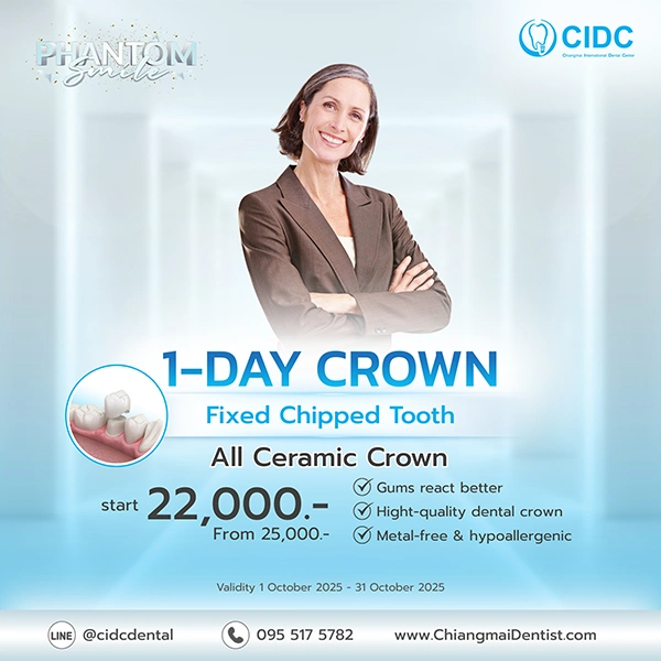 promotion dental crowns