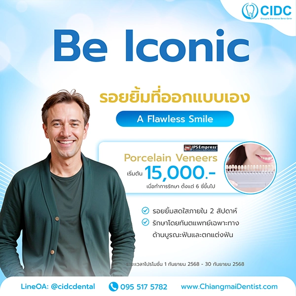 ราคา วีเนียร์เชียงใหม่
