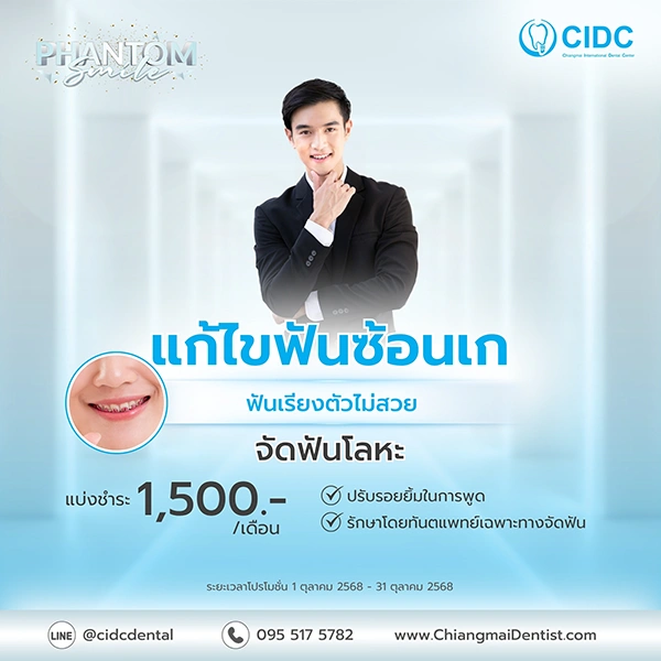 จัดฟันราคา