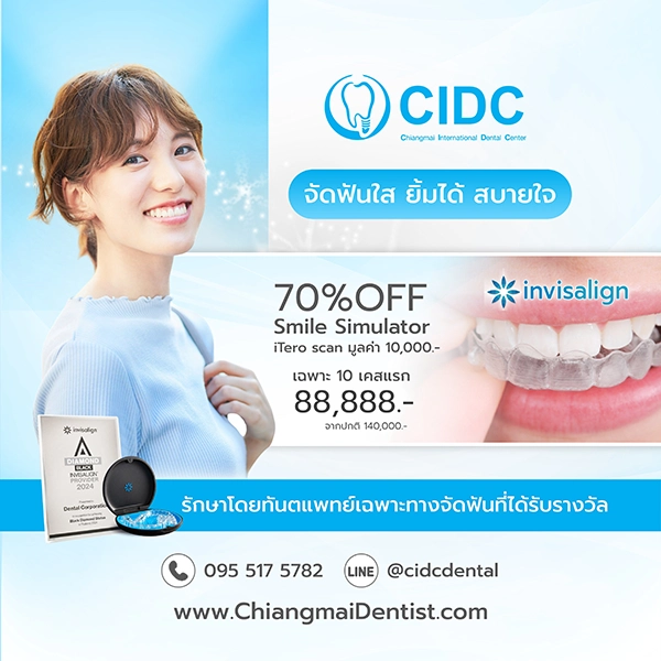 จัดฟันใส เชียงใหม่