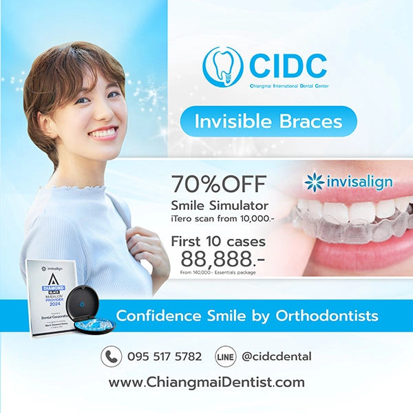 promotion Invisalign