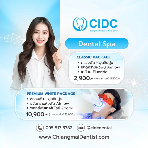 โปรโมชั่นสปาฟันขาว เชียงใหม่
