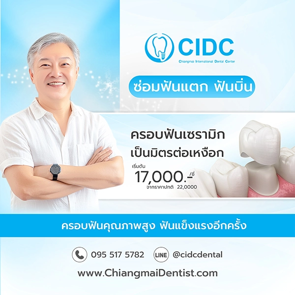 ครอบฟัน ราคา เชียงใหม่