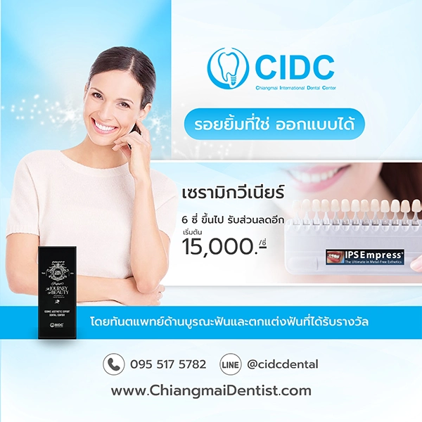 ราคา วีเนียร์เชียงใหม่