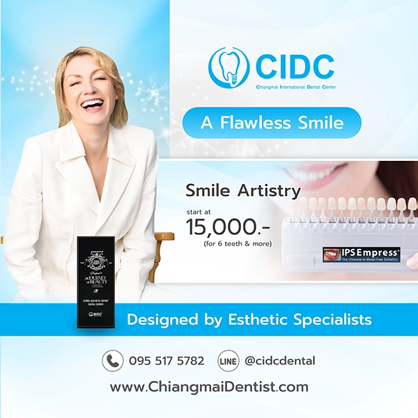 promotion dental veneer