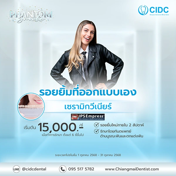 ราคา วีเนียร์เชียงใหม่