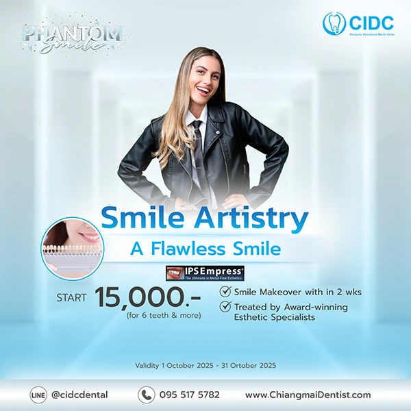 promotion dental veneer
