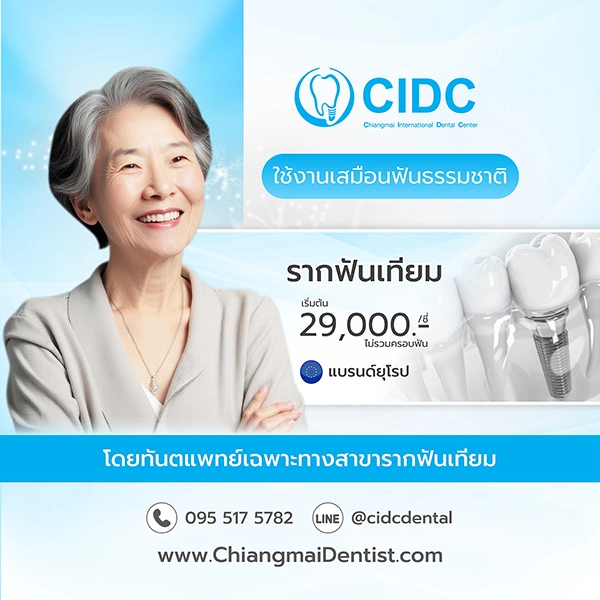 ราคารากฟันเทียม 2568