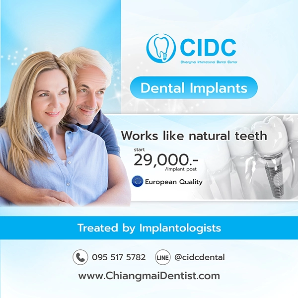 promotion dental implant
