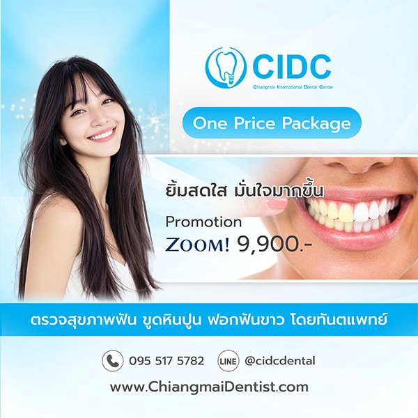 โปรโมชั่นฟอกฟันขาว เชียงใหม่