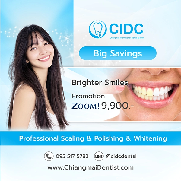 promotion Whitening Teeth